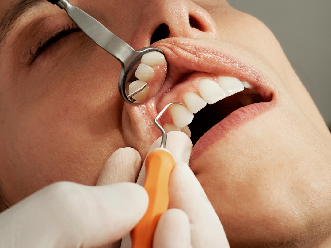Signs of Gum Disease You Shouldn't Ignore (Early Warning Symptoms)