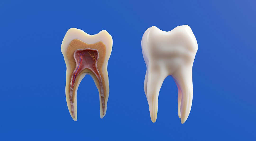Periodontal Disease Stages: What Happens When Gingivitis Goes Untreated